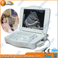 Sun-806L LCD portable ultrasound equipment & portable ultrasound at wholesale price/Laptop ultrasound